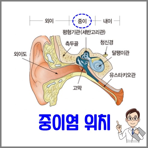 중이염의 발생위치는 외이와 내이 사이인 중이 부분이다