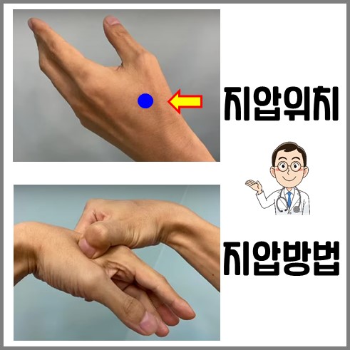 물설사 멈추는법 : 손등 지압위치와 방법 사진