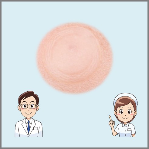 점빼고 재생테이프 붙인 사진