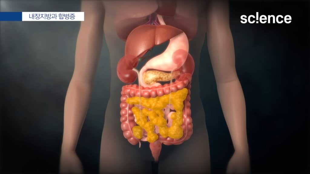 내장지방은 여러가지 합병증을 일으키는데 연관된 내장 사진 일러스트