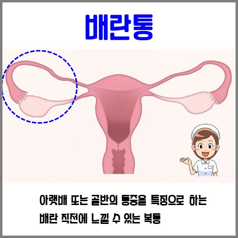 배란통 설명과 사진