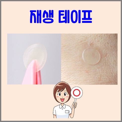 점빼고 재생테이프 붙임