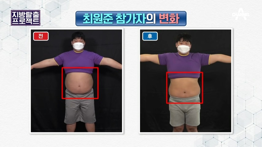 방송 참가자의 복부 변화 사진