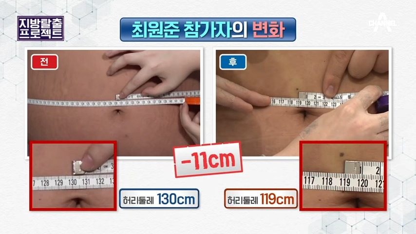 방송 참가자의 허리둘레 변화 사진